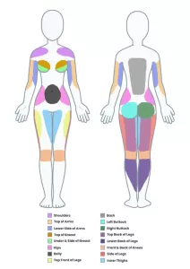 a4 stretch mark areas.png